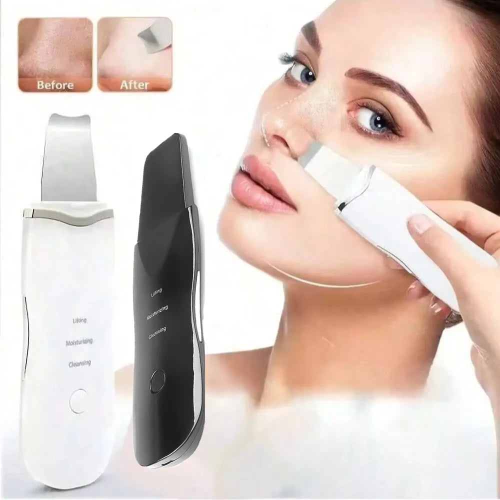 Ultrasonic Skin Scrubber - Professional Facial Cleaner & Blackhead Remover for Deep Pore Cleansing