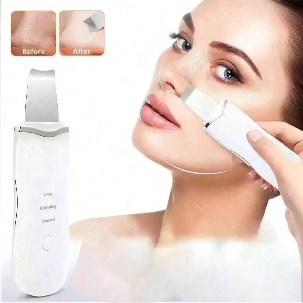 Ultrasonic Skin Scrubber - Professional Facial Cleaner & Blackhead Remover for Deep Pore Cleansing