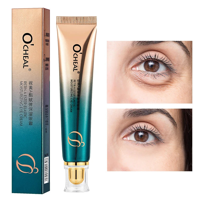 O'CHEAL Retinol Eye Cream - Anti-Aging & Dark Circle Treatment