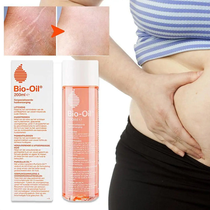 Multi-purpose Body Skin Care Essential Oil Fades Stretch Marks.