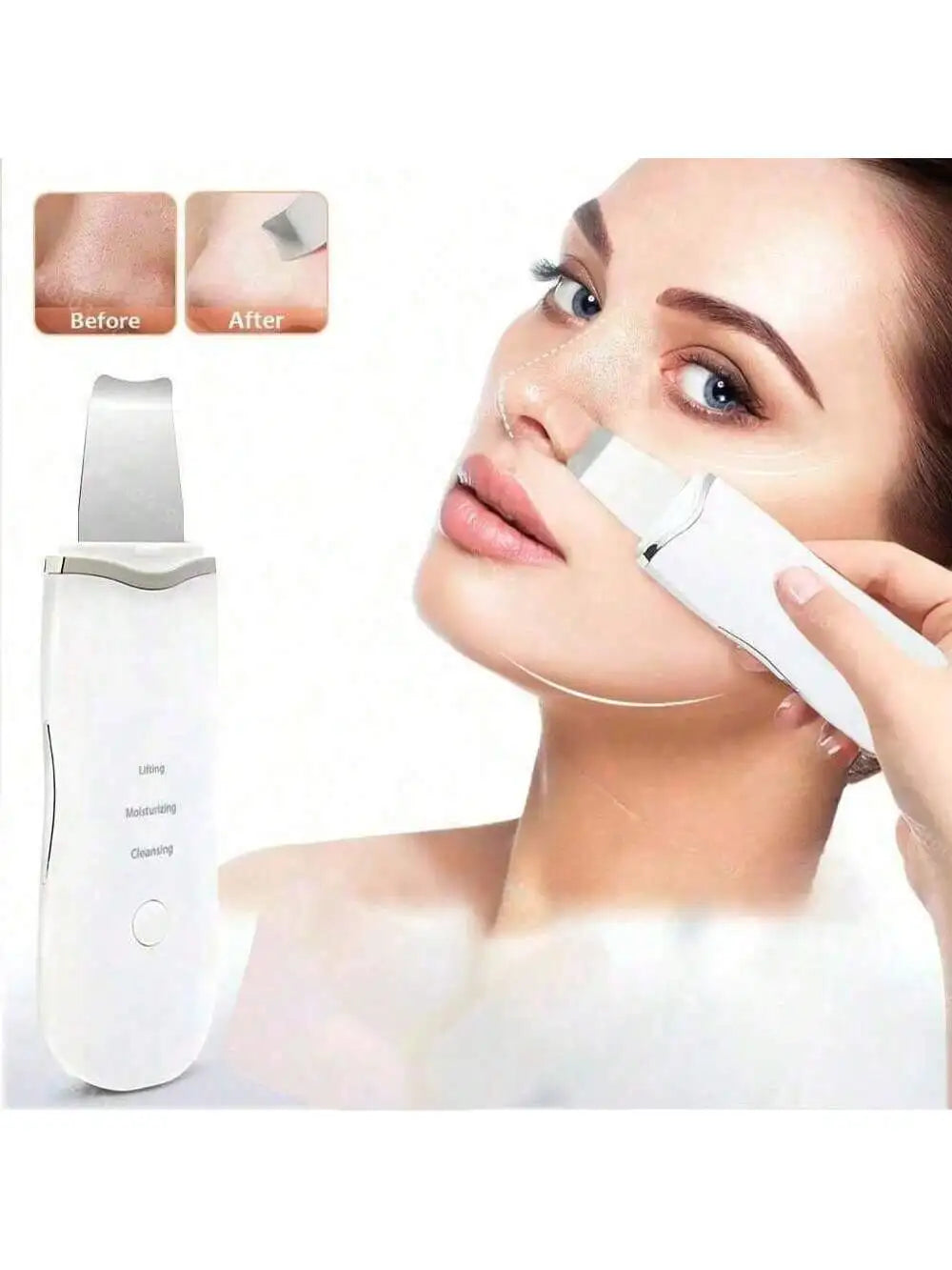 Ultrasonic Skin Scrubber - Professional Facial Cleaner & Blackhead Remover for Deep Pore Cleansing